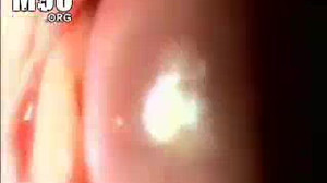 Вставили камеру в пещерку